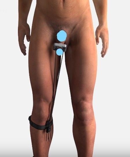 A device to increase membership