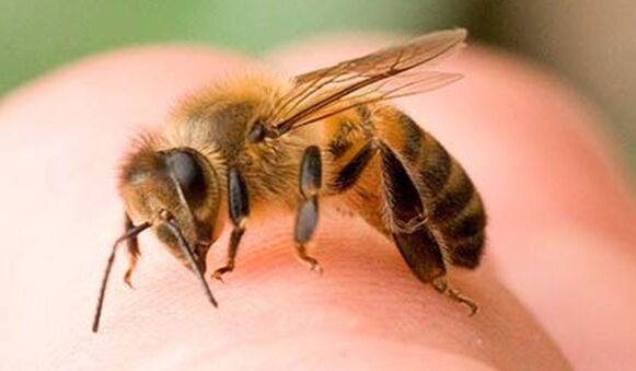Bee sting - an extreme way to enlarge the penis